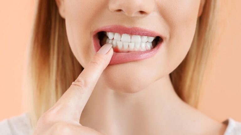 بیماری‌های لثه