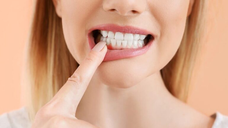 بیماری‌های لثه