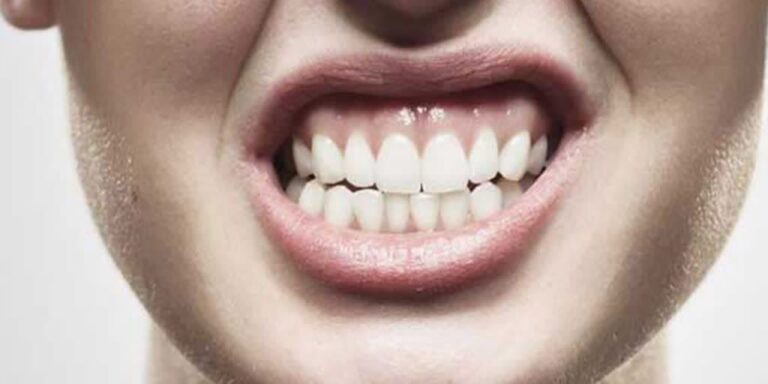 ‏دندان قروچه