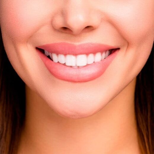 اصلاح طرح لبخند