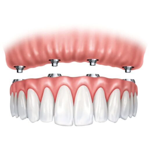 متخصص پروتز دندان در فردیس