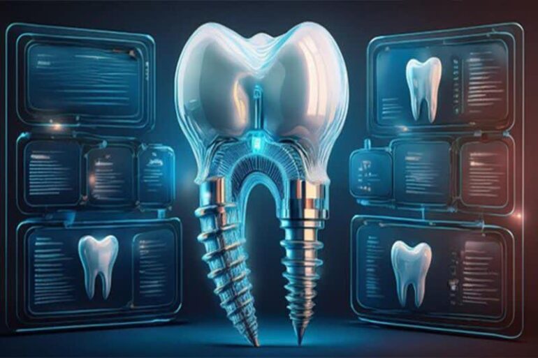 مراقبت بعد از ایمپلنت دندان