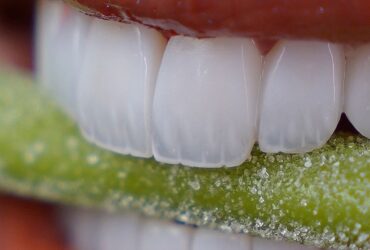 کامپوزیت دندان قیمت